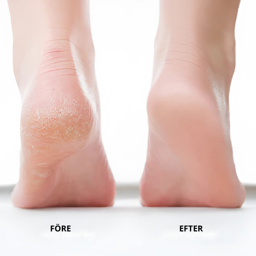 SilkFeet Pro - Elektrisk Fot Fil